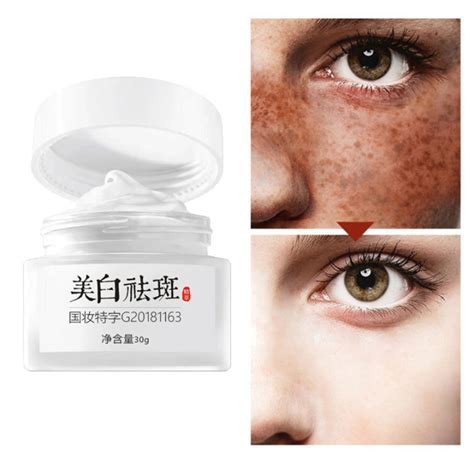 Dark Spot Corrector Cream Whitening Freckle Cream Powerful Removing