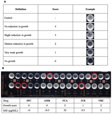 The Interpretation Of How To Read The Atb Fungus 3 Strips Visually A