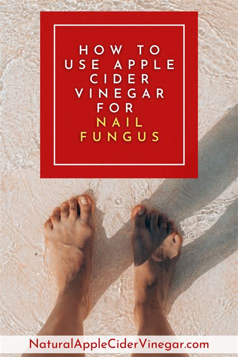 How To Use Apple Cider Vinegar For Nail Fungus All Natural Home
