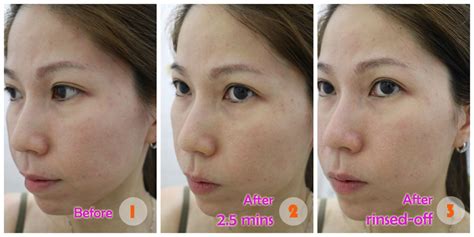 Review At Home 40 Glycolic Acid Peel From Muac Part 1