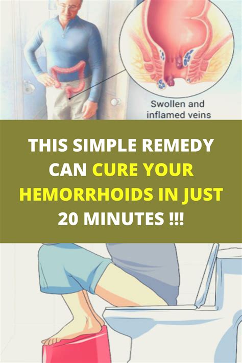 This Simple Remedy Can Cure Your Hemorrhoids In Just Minutes