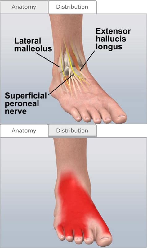 Top Of Foot Tingling Complete Treatment Guide