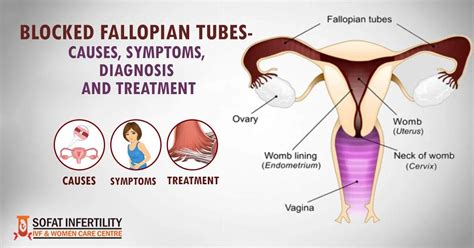 Fallopian Tube