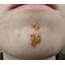 17 Common Skin Rashes In Children  DailyHealthTips
