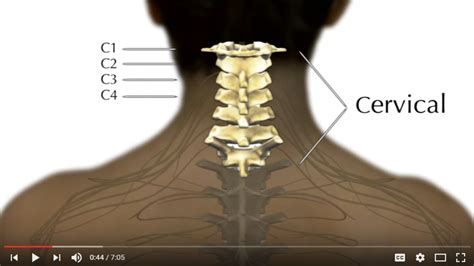 Cervical Spinal Cord Lesions