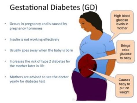 Gestational Diabetes Abda