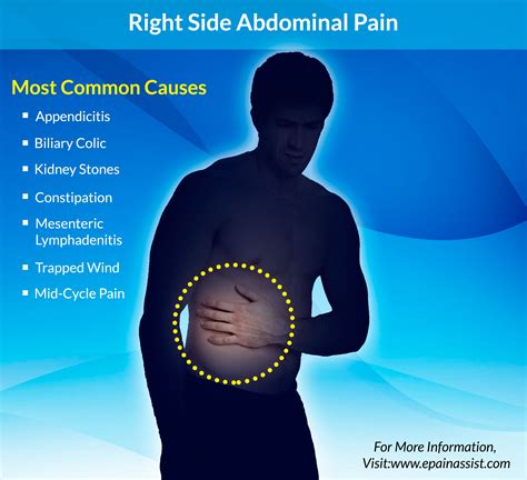 Abdominal Pain Pictures
