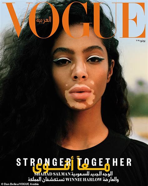 Winnie Harlow Covers Vogue Arabia With Another Model Who Has Vitiligo