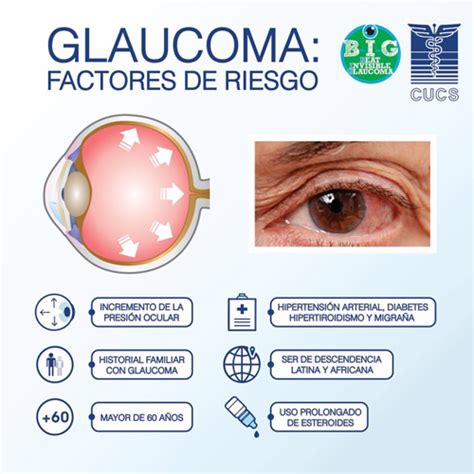 Oftalmología Global Glaucoma Institute