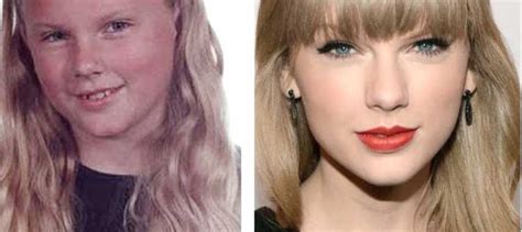 Taylor Swift Plastic Surgery Let S See How Her Looks And Styles Have Evolved Through The Years