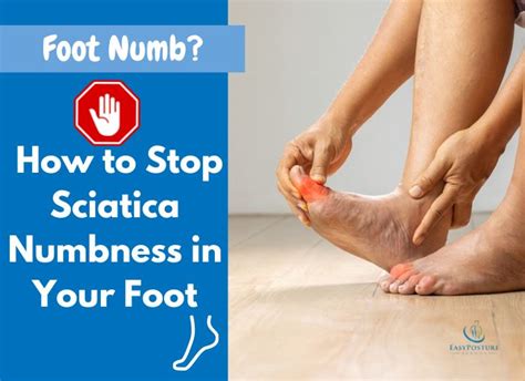 Sciatica Numb Foot How To Stop Sciatica Numbness In Foot Easy
