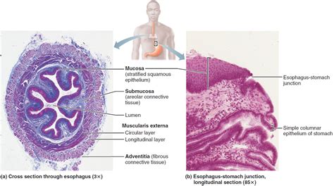 Esophageal Cancer Causes Signs Symptoms Treatment