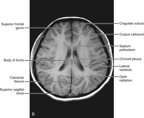 Normal Anatomy Radiology Key