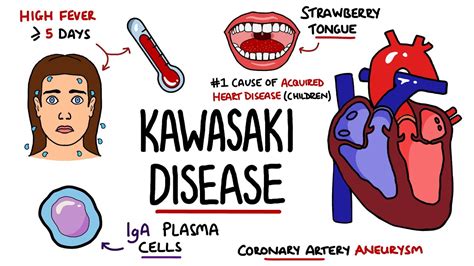 Kawasaki Disease Explained Includes Criteria And Mnemonic Youtube