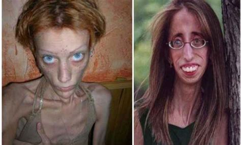 Pics Of The Ugliest Women That Can Be Found On The Internet Ftw