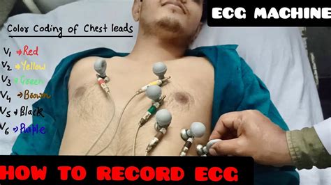 How To Record Ecg Ecg Leads Color Coding And Placement Location Ecg