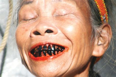 Como curar dientes podridos, o los dientes picados es una de las preguntas que nos hace si tenemos este problema dental o no esta por generar recién. Tener los dientes negros es un signo de belleza entre las ...