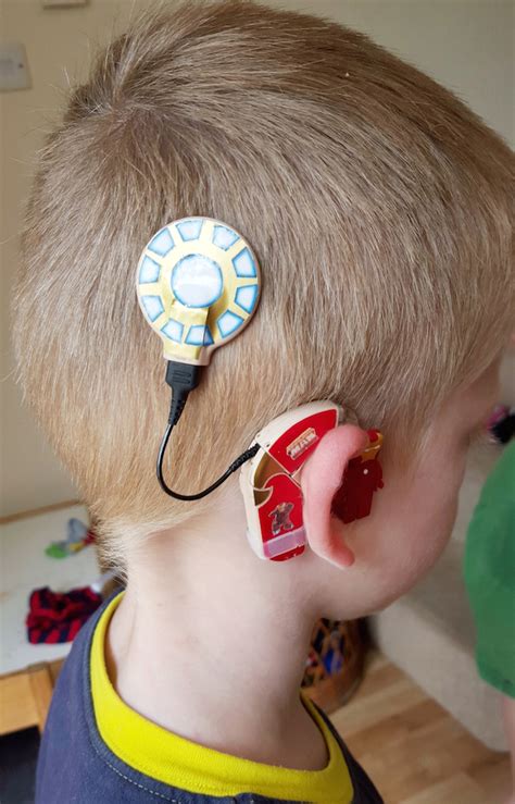Creative Mom Turns Childrens Hearing Aids Into Superheroes To Boost