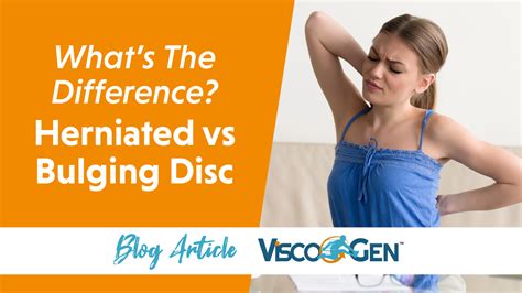 Whats The Difference Between A Bulging Vs A Herniated Disc Viscogen