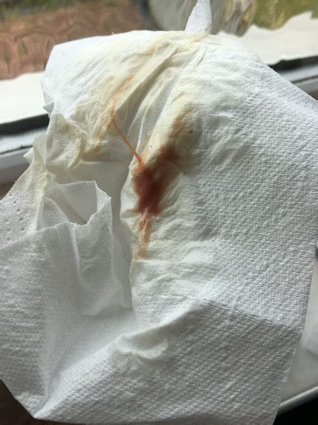 Implantation Bleeding Just When Wiping Maternity Photos My Xxx Hot Girl