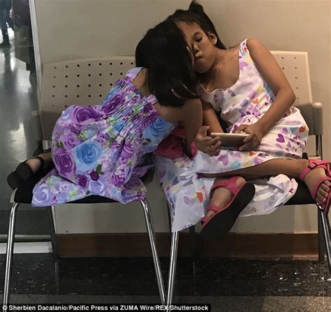 Conjoined Filipino Twins To Separate Despite Death Risk Daily Mail Online