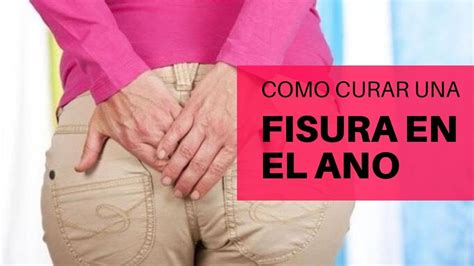 Como Curar Una Fisura Interna En El Ano Fisura Anal Tratamiento Y Falsos Mitos Youtube