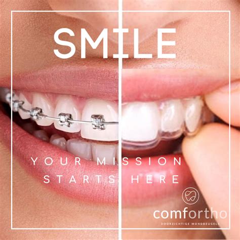 Invesalign 5 Amazing Benefits Of Invisalign In 2019 Weiss Tor