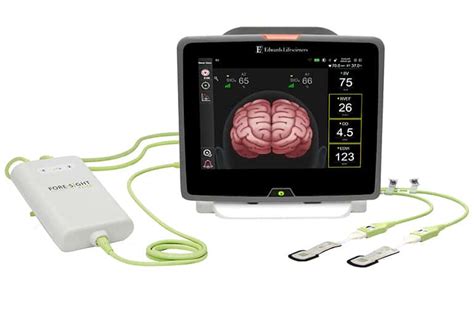 Edwards Foresight Brain Oxygenation Sensors Fda Cleared To Pair With