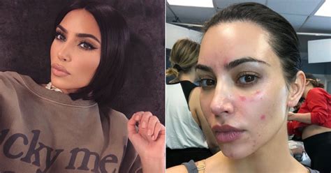 Kim Kardashian Parle De Son Psoriasis Avec Des Photos Makeup Jet
