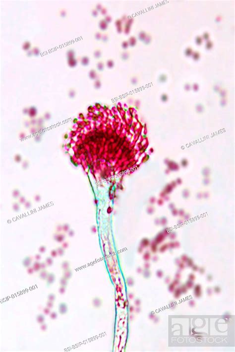 Aspergillus Fumigatus Fungus Responsible For Severe Infections As