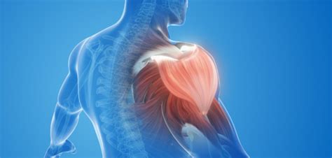 Muscle Spasm Symptoms Causes And Treatment Healthclust