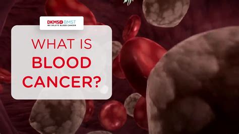 What Is Blood Cancer Youtube