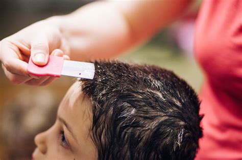 How To Get Rid Of Head Lice And Nits Petit Journey