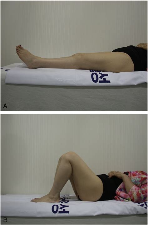 Fracture of the Medial Femoral Condyle After ...