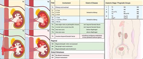 Bladder And Renal Cell Carcinomas Clinical Gate