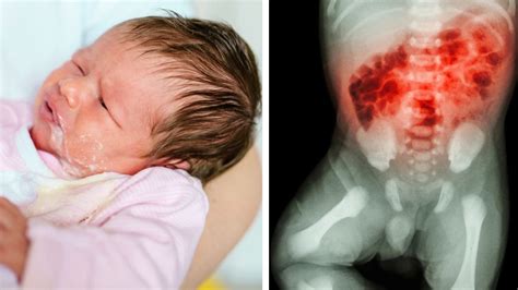 El peligro de darle probaditas a tu bebé antes de los meses si tu leche no lo llena Salud