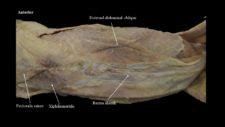 Cat musculature | Atlas of Comparative Vertebrate Anatomy