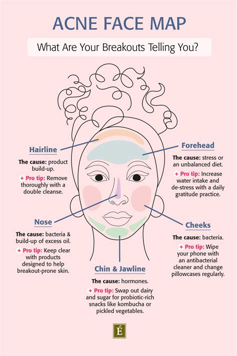 Acne Face Map What Are Your Breakouts Telling You Eminence Organic Skin Care