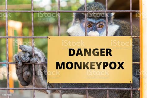 Monkeypox Virus Dangerous Disease Spreads In World Concept Of Smallpox
