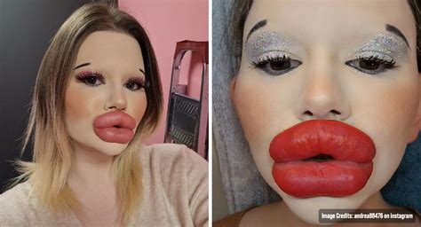 woman with world s biggest lips now wants huge cheekbones