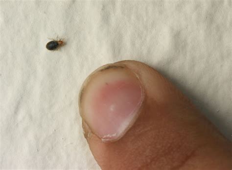 I Found A Bed Bug Crawling On Me At Work Bed Western