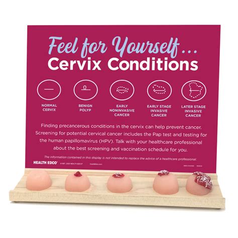 Feel For Yourself Cervix Conditions Display Health Edco