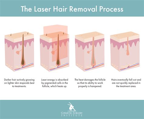 Laser Hair Removal Palm Desert Cosmetic Surgery Institute