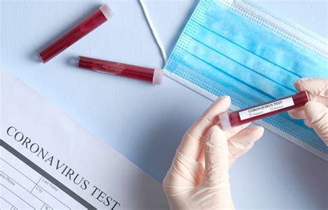 Meist sind das zwei oder mehr spezifische gene. Coronavirus: ¿cómo funcionan los test de diagnóstico de la ...