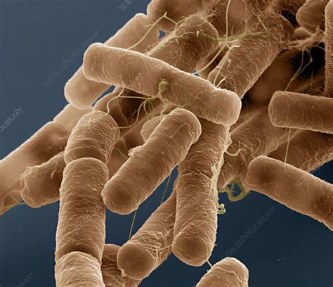 Bacillus Cereus Bacteria Sem Stock Image C0090417 Science Photo
