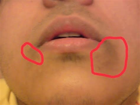 Dark upper lip could be the outcome of a number of reasons when you look into it. Pin on beauty Tips