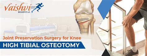 Joint Preservation Surgery For Knee High Tibial Osteotomy