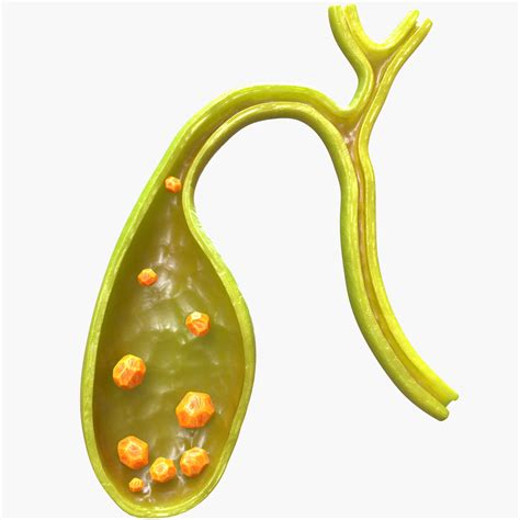 Gallbladder With Gallstones 3d Model By Zames1992d