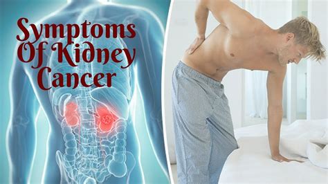 Therefore, symptoms of the disease usually appear when the tumor grows large and begins to. SYMPTOMS OF KIDNEY CANCER - YouTube