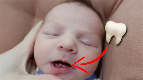 Our Newborn Baby Was Born With Teeth Very Rare Youtube